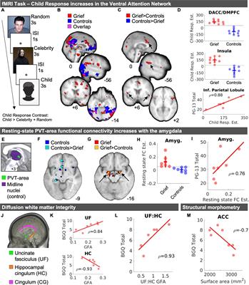 Why do mothers never stop grieving for their deceased children? Enduring alterations of brain connectivity and function